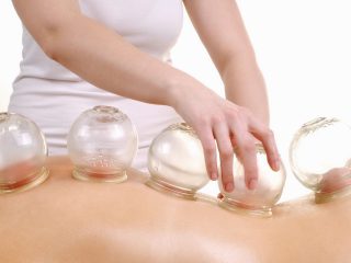 Cupping Treatment