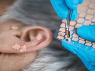 Ear Acupuncture Point Therapy